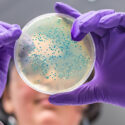 Vyšetření mikrobiomu